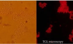 Labelled S. aureus cells illuminated under TGL microscopy