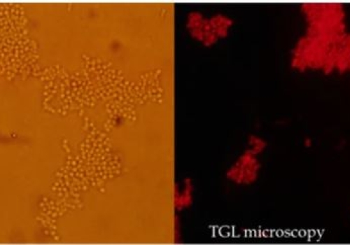 Labelled S. aureus cells illuminated under TGL microscopy